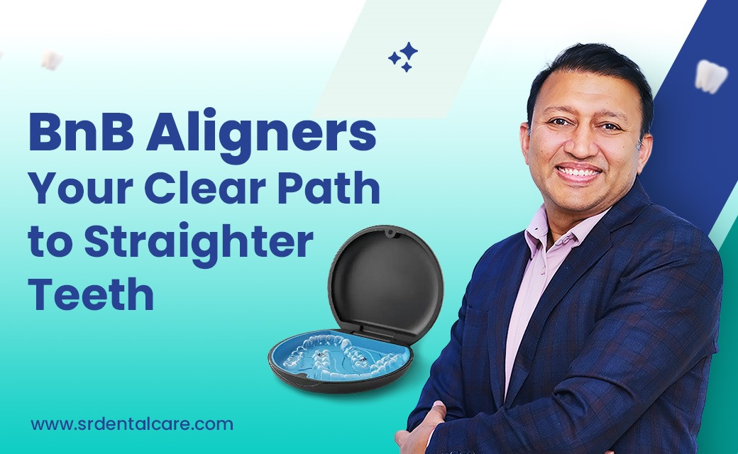 How BnB Aligners Works: A Clear Path to Straighter Teeth