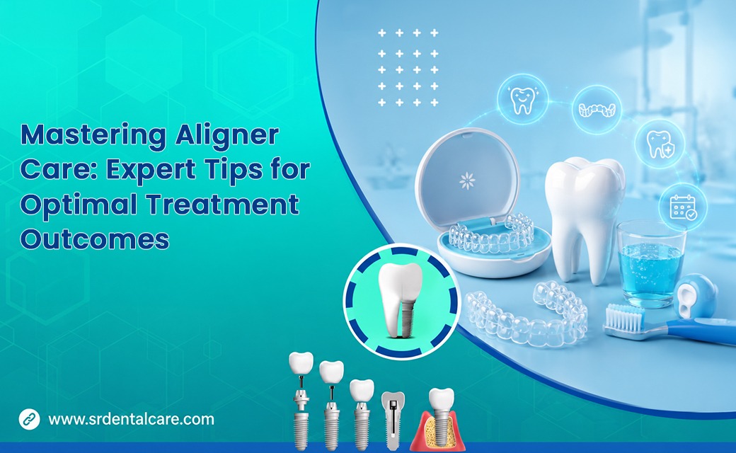 Mastering Your Aligner Journey: The Ultimate Guide to a Perfect Smile