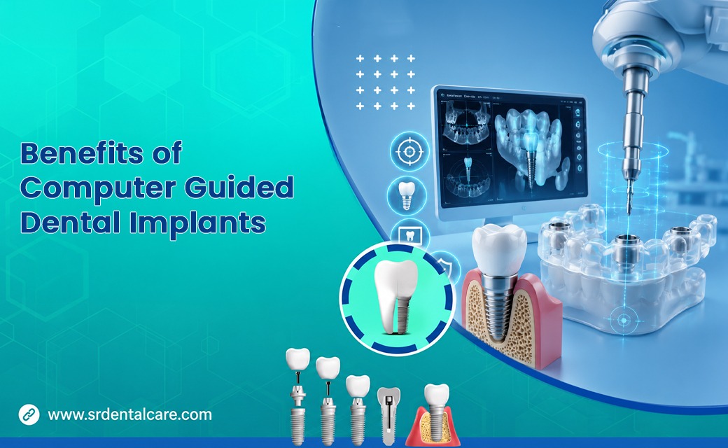 The Future of Smiles: Your Complete Guide to Computer Guided Dental Implants