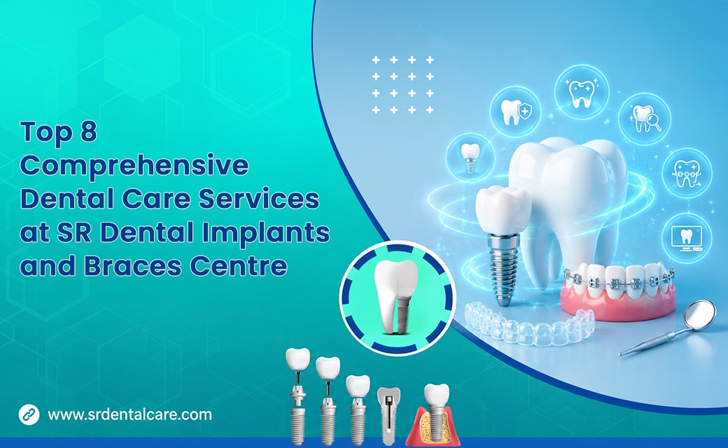 The Ultimate Guide to Your Best Smile: 8 Transformative Services at SR Dental Implants and Braces Centre